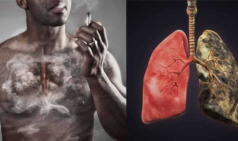 O asistentă explică cum îți afectează fumatul, plămânii!