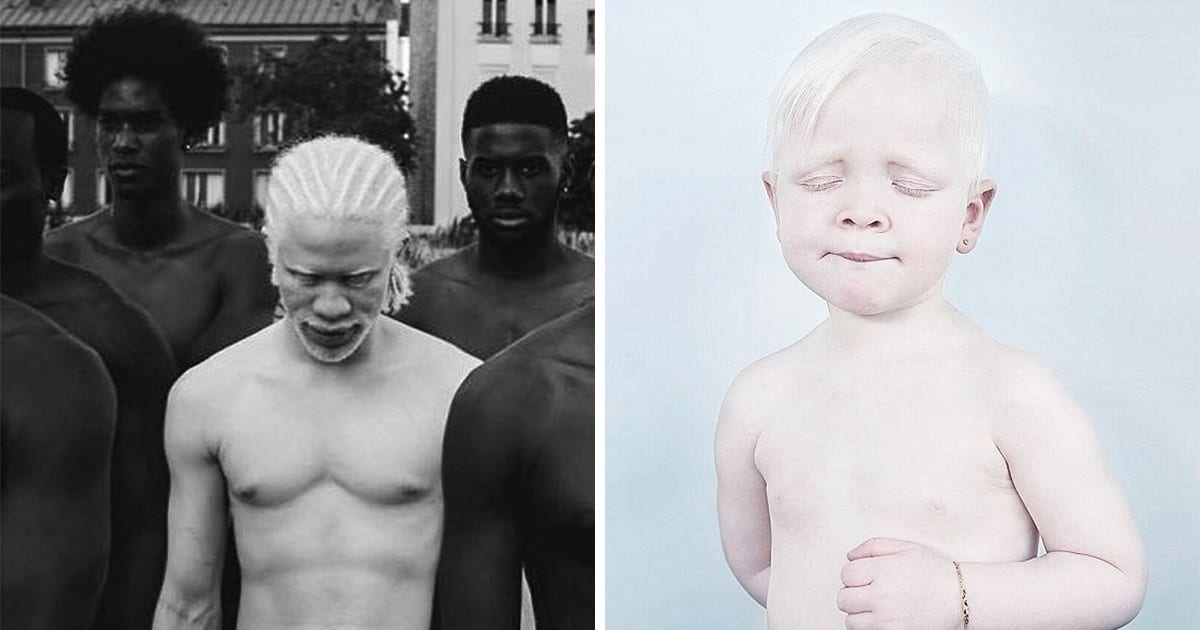 Aceste fotografii surprind frumusețea unică a oamenilor Albino, iar noi nu avem dreptul sa ii judecam!