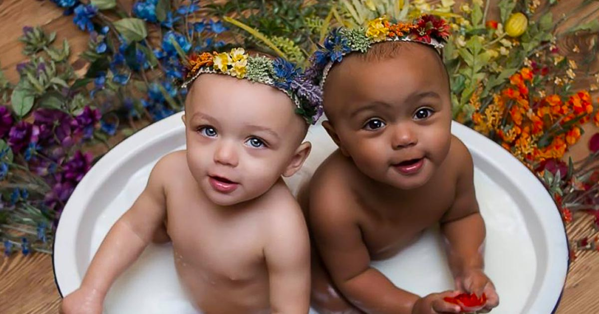 Primele gemene din lume care au culori diferite ale pielii au crescut. Medicii spun ca exista o sansa la un milion ca acest lucru sa fie posibil!